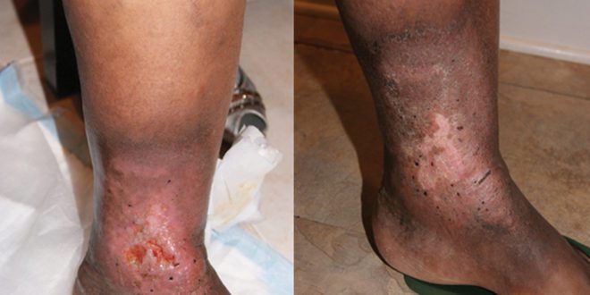 Ayusya Home Health Care Pvt LtdBangaloreChennaiMadurai