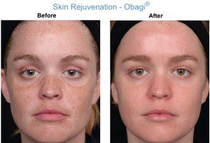 Keeping Your Skin Looking Forever Young