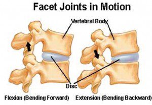 What is Cervical Facet Syndrome