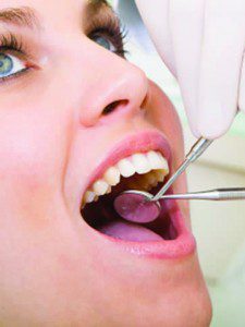 Dental Prophylaxis - Naples