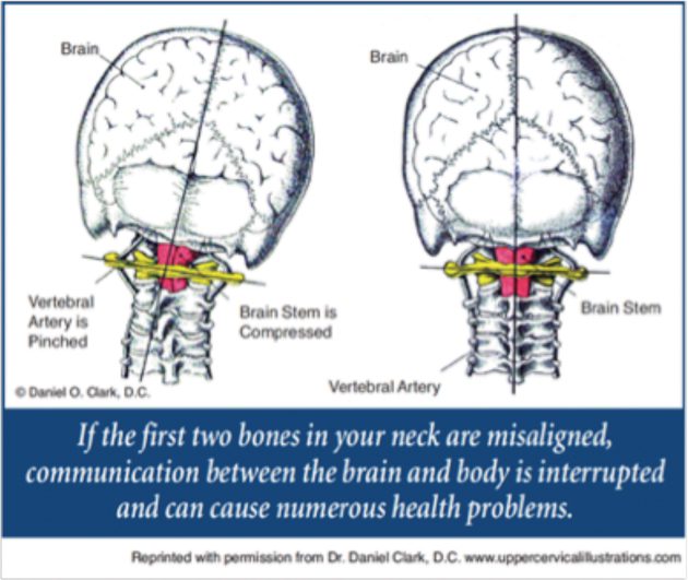 Is Your Head on Straight