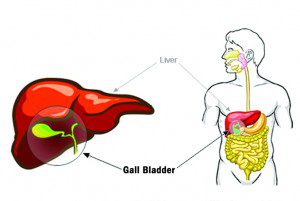 Gallbladder Disease 