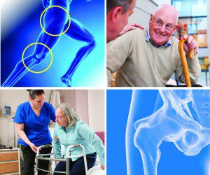 Joint Replacement Surgery