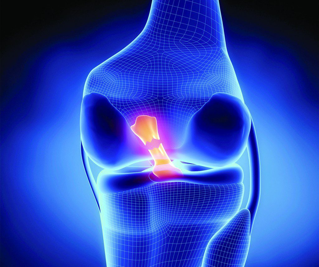 Knee Injuries • Southwest Florida's Health and Wellness Magazine