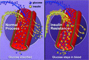 Cardiovascular Health and Diabetes Education