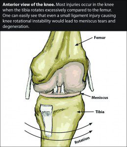 Regenerative Injection Therapy