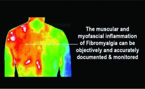 Autoimmune Diseases Are Frustrating to Diagnose