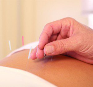 Are All Acupuncture Providers Created Equal?