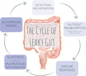 Is a Leaky Gut Causing You Problems?