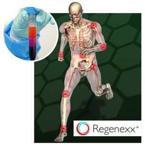 Stem Cells-setting the New Standard for Treatment of Orthopedic Conditions