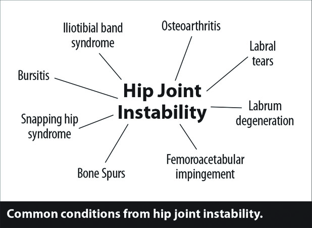 Regenerative Treatments For Labral Tears And Osteoarthritis Of The Hip • Southwest Floridas 