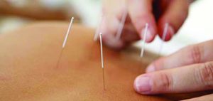 Reasons Why You Should Come  in for an Acupuncture Tune-Up