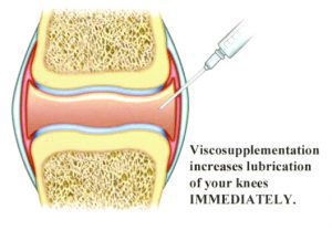 FDA Approved Joint Injections