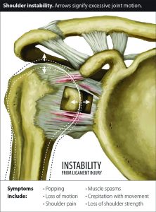 Labral Tears and Rotator Cuff Injuries – Regenerative Treatments for ...