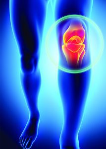 Why Your Knee Replacement Surgery  Should Be Customized