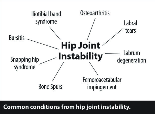 Treatment Options For Osteoarthritis Of The Hip • Southwest Florida S Health And Wellness Magazine