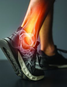 Ankle Pain Can Be A Sign  Of Major Degeneration