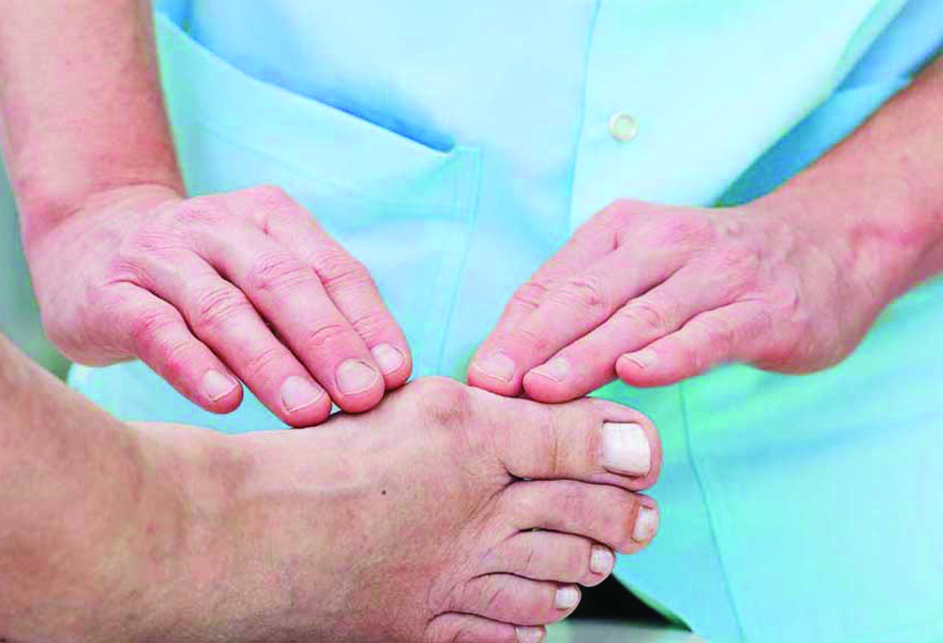 Do You Have A Protrusion On Your Big Toe? Find Out How You Can Get Rid