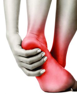 Should You Seek Medical  Help for Heel Pain