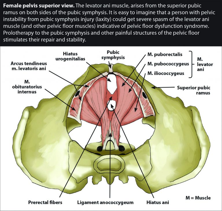 Ligament Laxity, the Missing Diagnosis in Pelvic Floor Dysfunction and ...