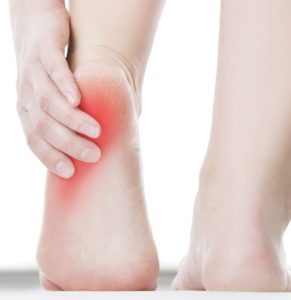 The Double-Sided Discomfort of Heel Pain