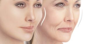 THE BASICS OF FACIAL FILLERS 