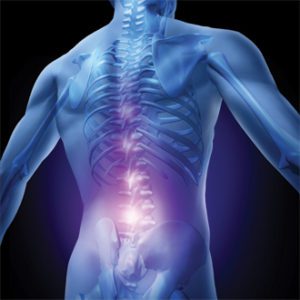 What Anyone Aged 50+ Needs To Know About Lower Back Pain Or Sciatica