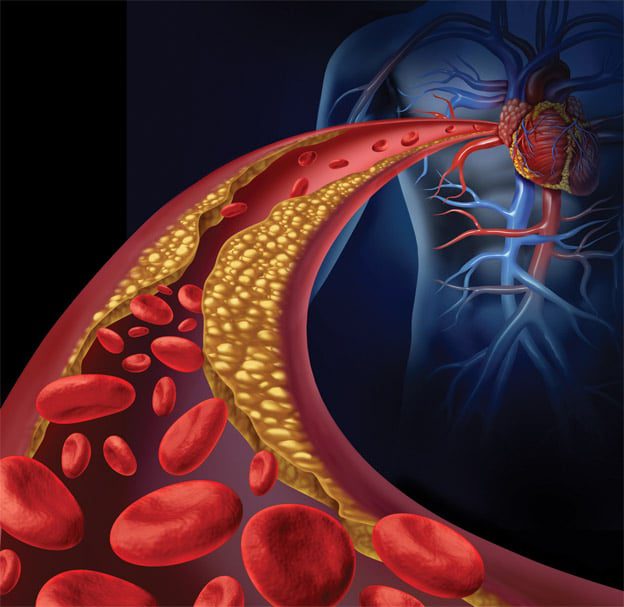 Decreasing Your Cardiovascular