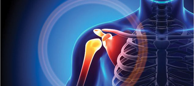 Shoulder Pain: Rotator Cuff Repair & Surgical Options | Southwest ...