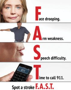 Stroke Awareness Month: What You NEED to Know About Prevention & Treatment