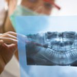 Digital Dental X-ray Exams Lower Radiation Exposure