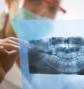 Digital Dental X-ray Exams Lower Radiation Exposure