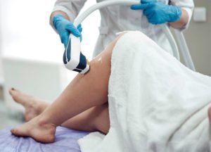 Does Laser Hair Removal Really Work