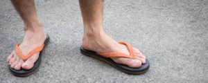 Proper Footwear & Why Diabetics Should Never Wear Sandals or Flip Flops