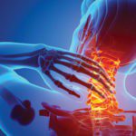 Did You Know the Pain in Your Neck Can be Alleviated with Physical Therapy?