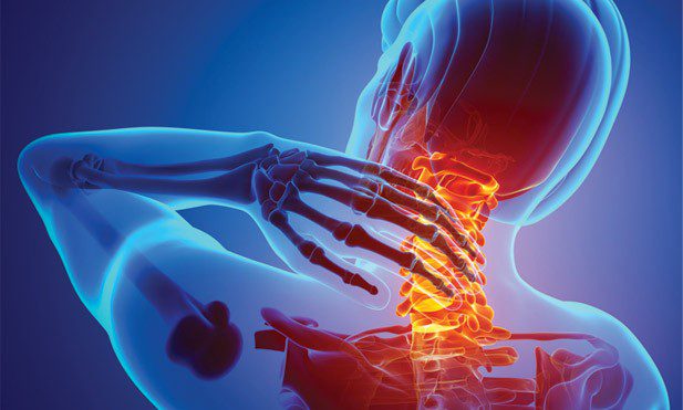 Did You Know the Pain in Your Neck Can be Alleviated with Physical Therapy?
