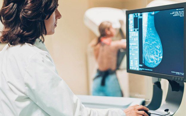 MAMMOGRAPHY