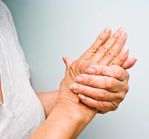 Rheumatoid Hand Arthritis