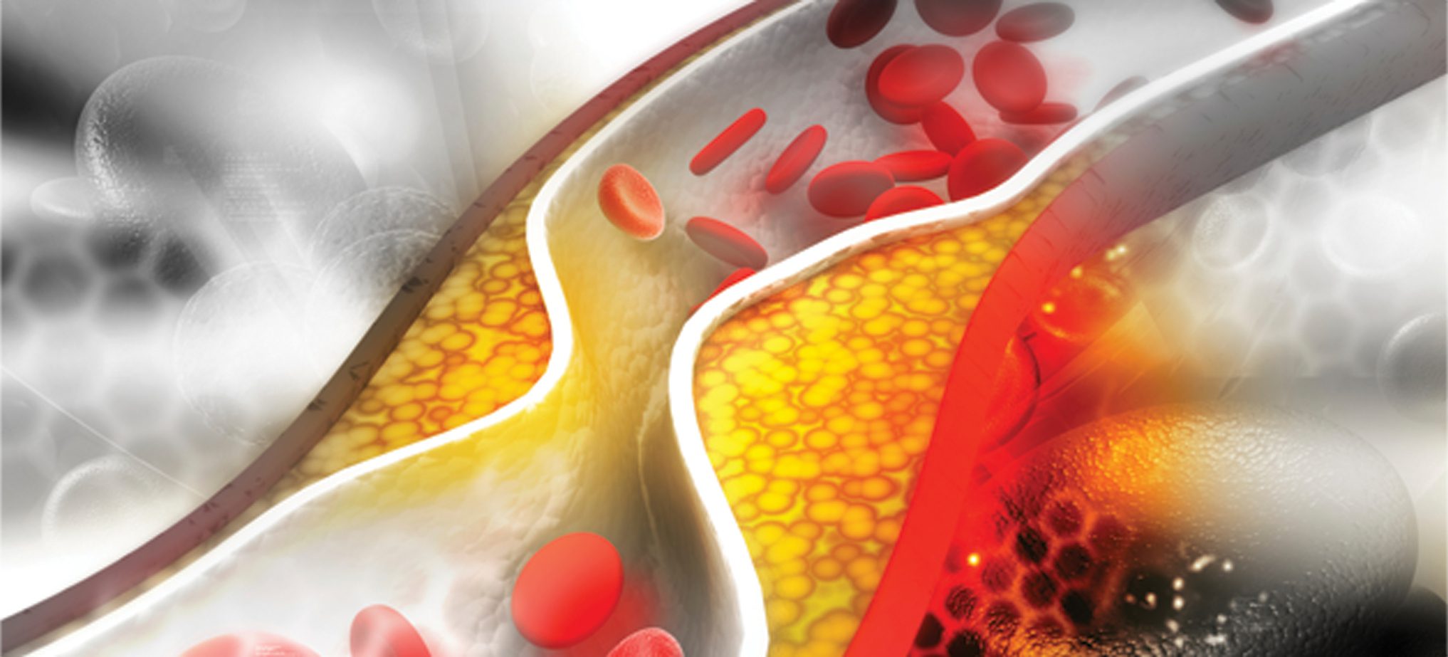 Methods for Lowering Cholesterol