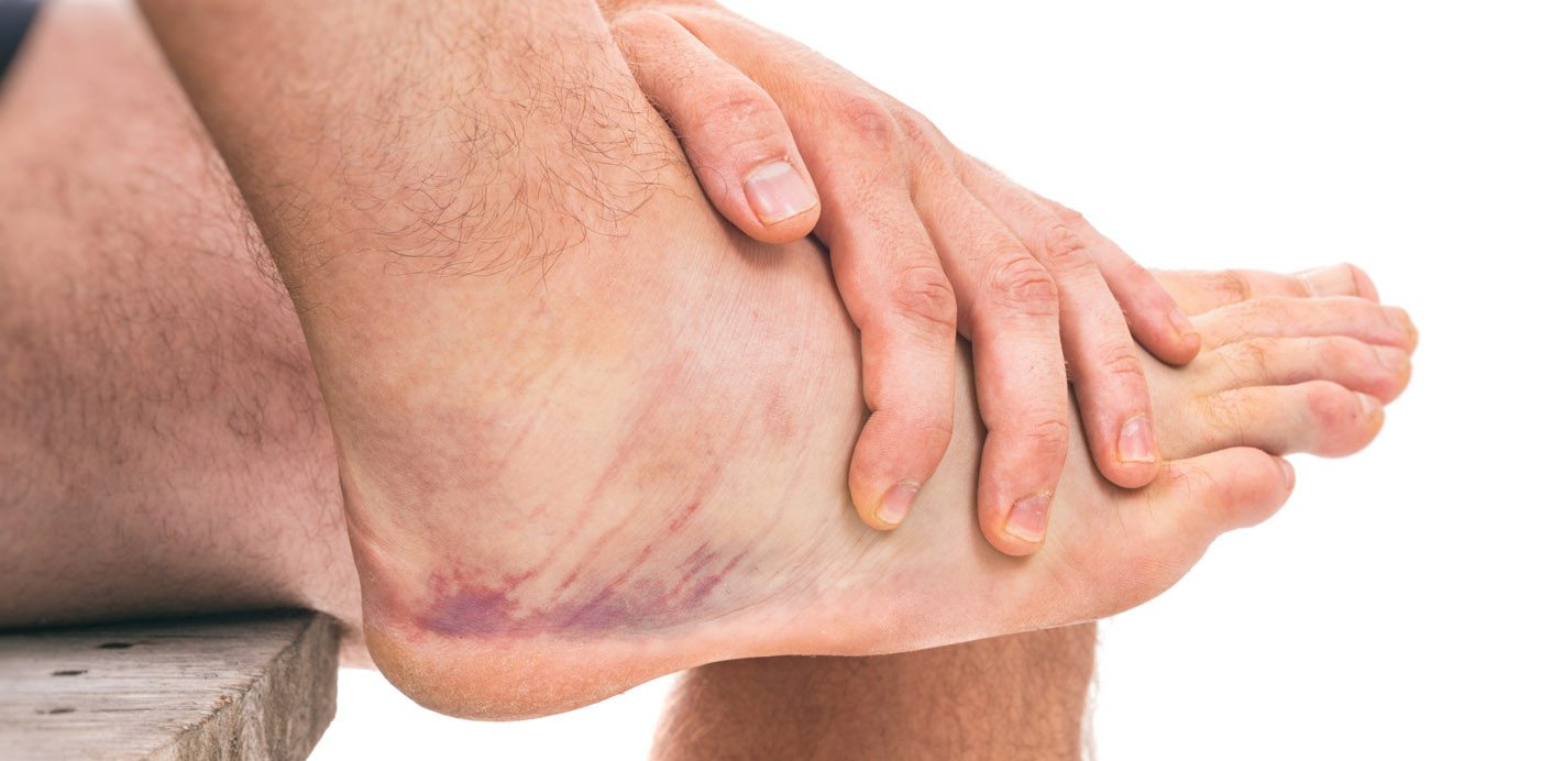 Five Foot Problems Men Should Never Ignore