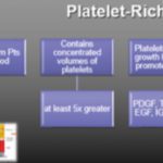 What is Platelet-Rich Plasma-PRP