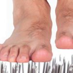 Peripheral Neuropathy