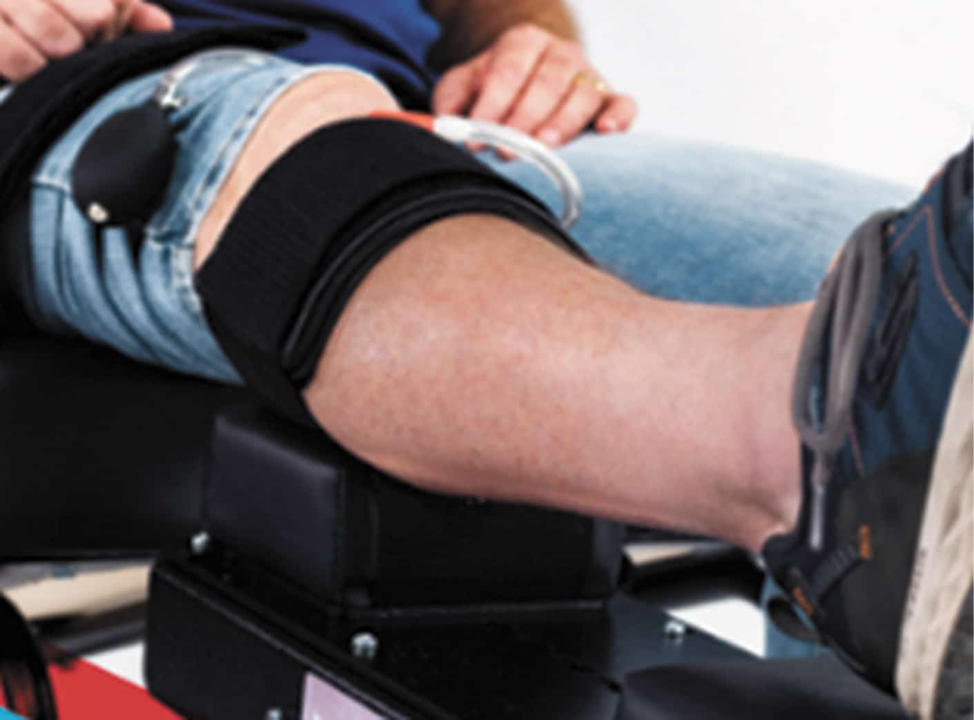 Osteoarthritis of the Knee