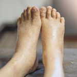 Diabetic Foot Infections