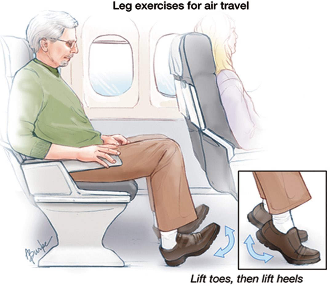 Peripheral Arterial Disease
