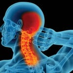 CERVICAL SPINE, NECK PAIN