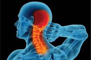 CERVICAL SPINE, NECK PAIN