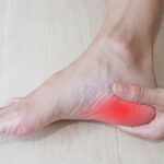 Plantar Fasciitis