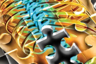 The Lumbar Spine Puzzle