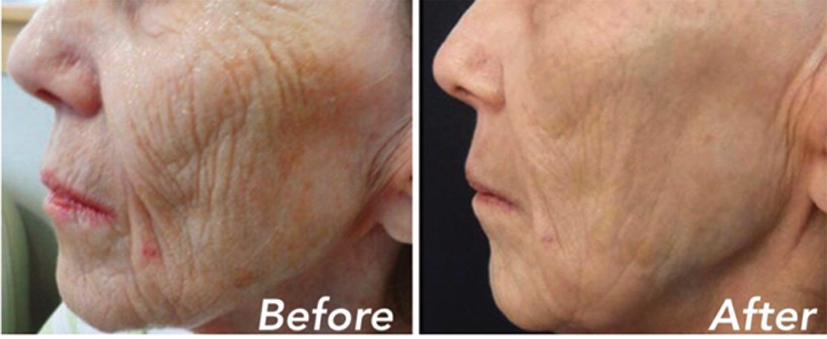 Wild Lily Grand Opening